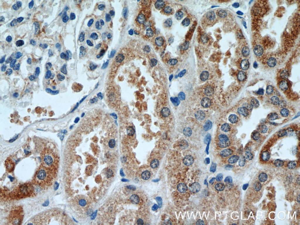 IHC staining of human kidney using 17857-1-AP