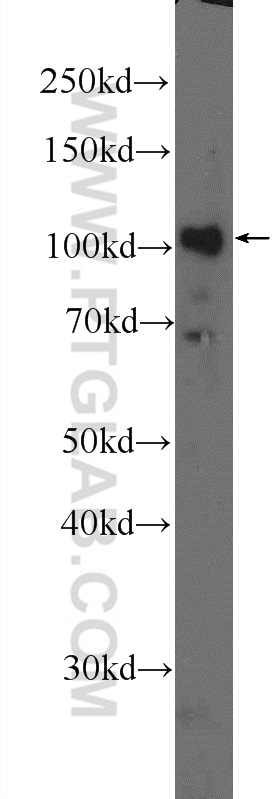 WB analysis of SMMC-7721 using 17857-1-AP