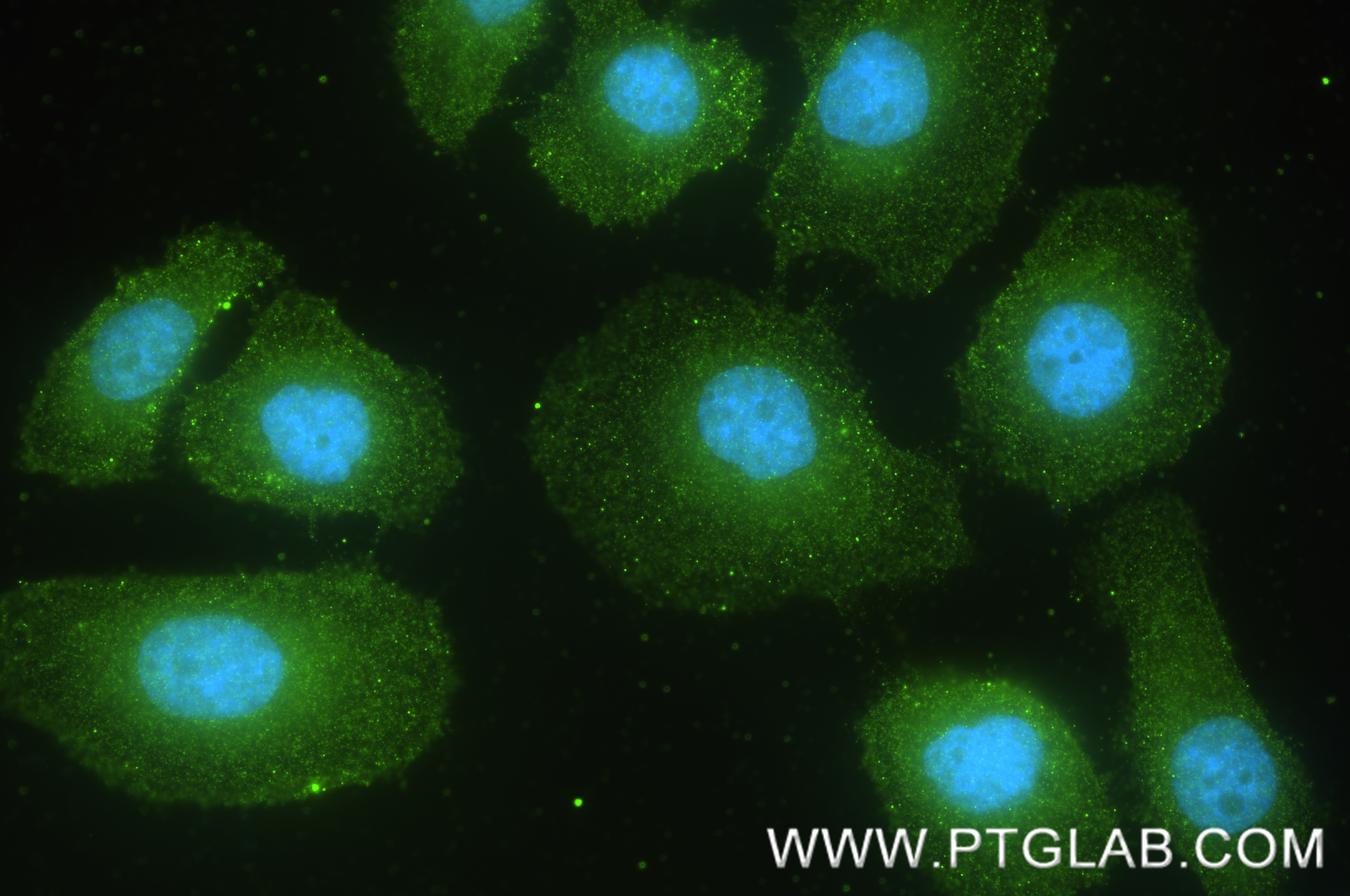 IF Staining of SGC-7901 using 85709-1-RR