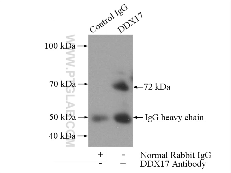 IP experiment of mouse brain using 19910-1-AP