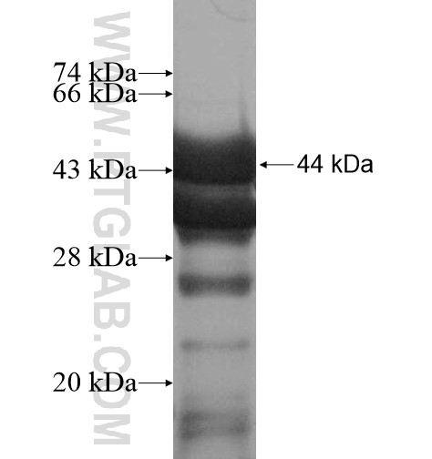 DDX17,P72 fusion protein Ag13777 SDS-PAGE DDX17,P72 fusion protein Ag13777 SDS-PAGE