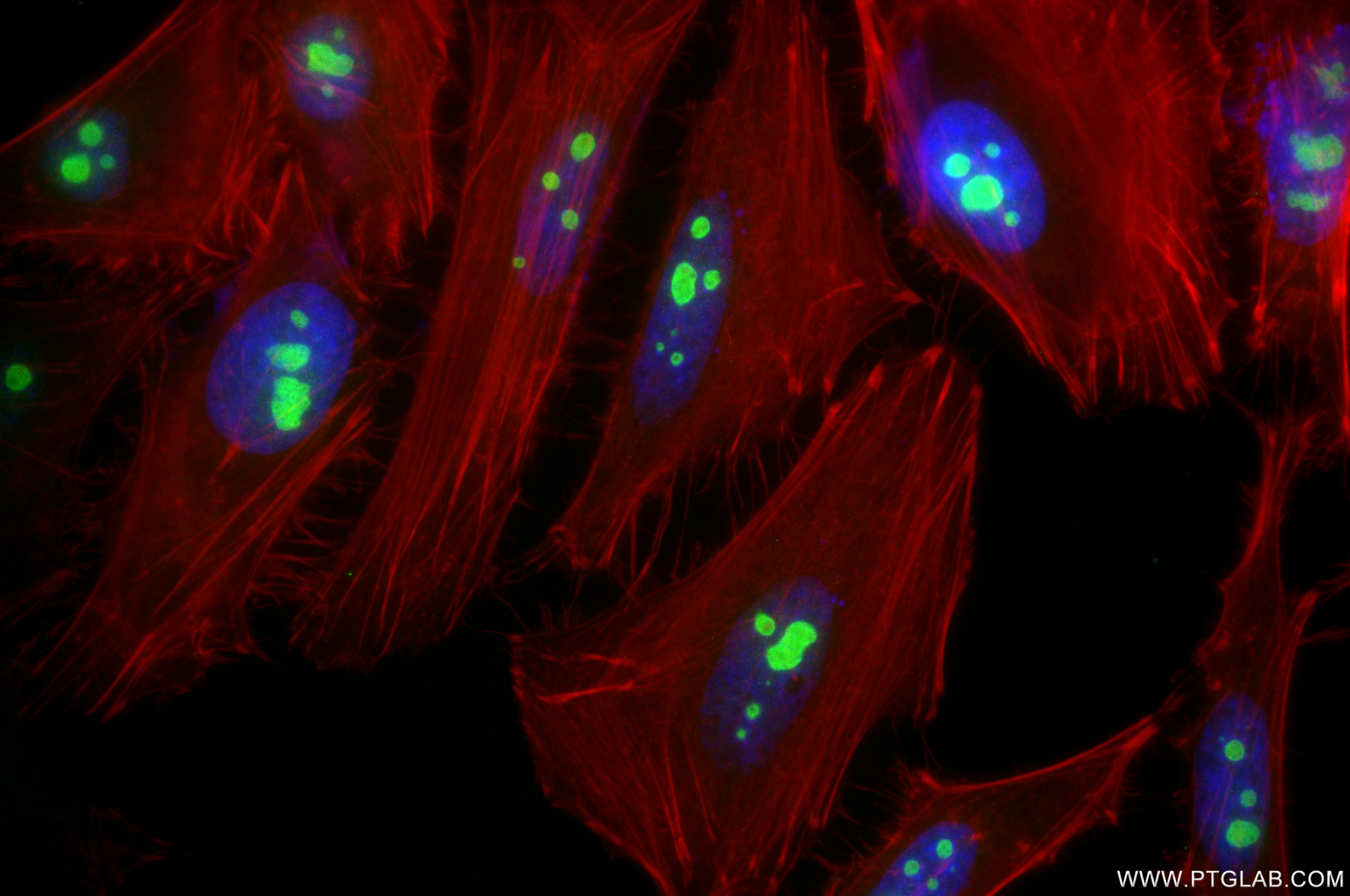 IF Staining of HeLa using 85789-2-RR (same clone as 85789-2-PBS)