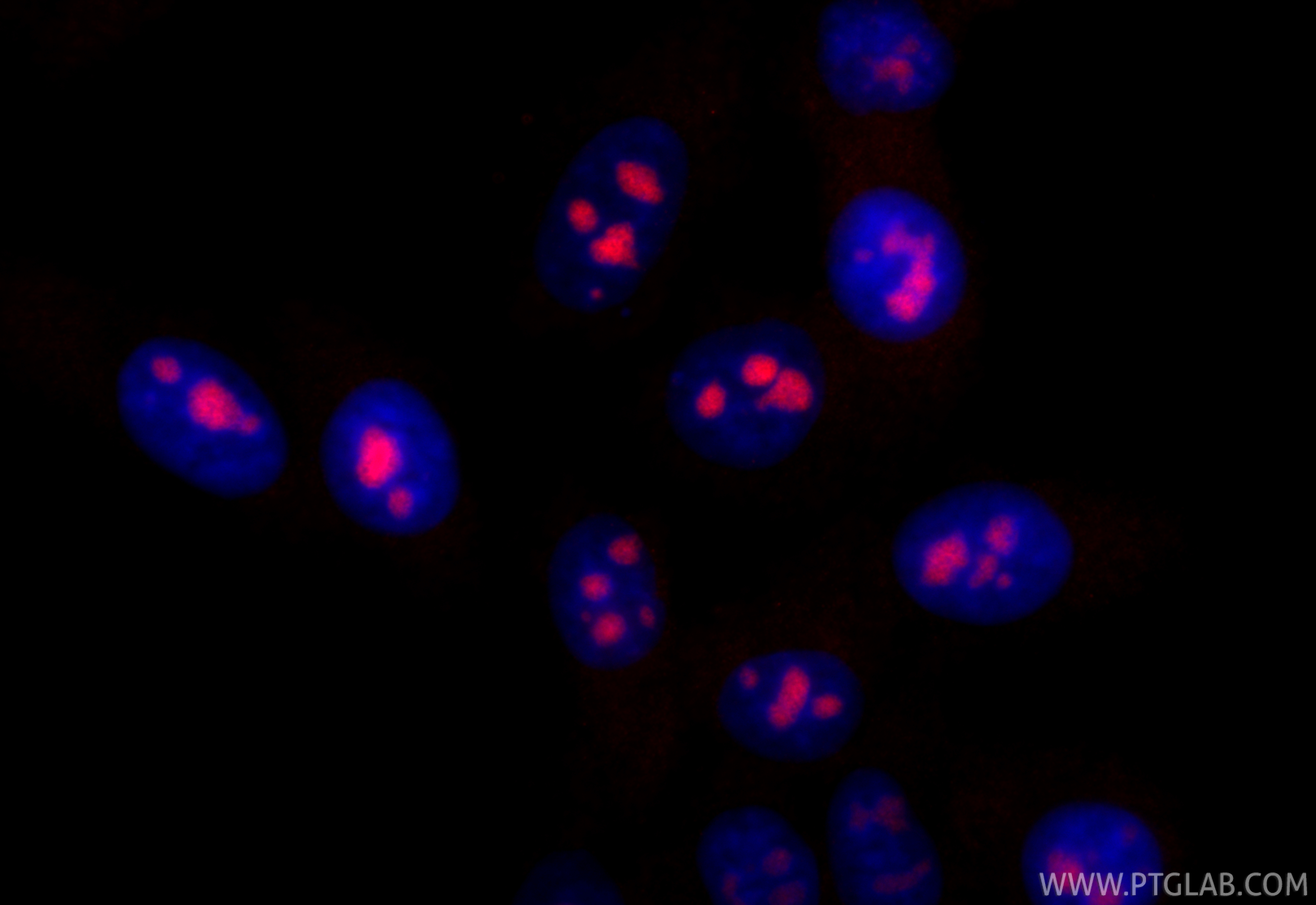 Immunofluorescent analysis of (4% PFA) fixed HepG2 cells using CoraLite®594 DDX18 antibody (CL594-85789-2, Clone: 250053A4 ) at dilution of 1:1000. IF Staining of HepG2 using CL594-85789-2