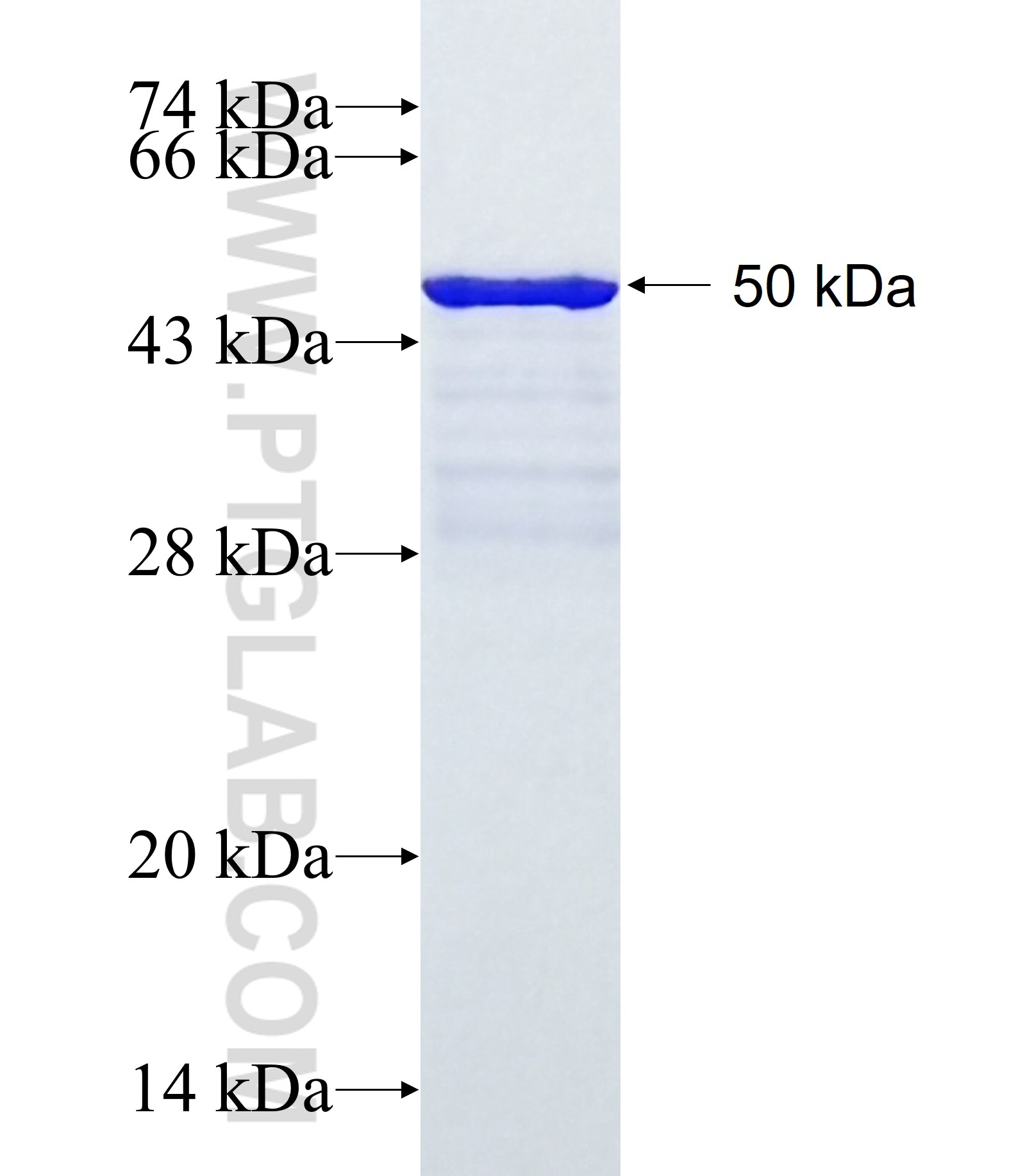 DDX18 fusion protein Ag27457 SDS-PAGE