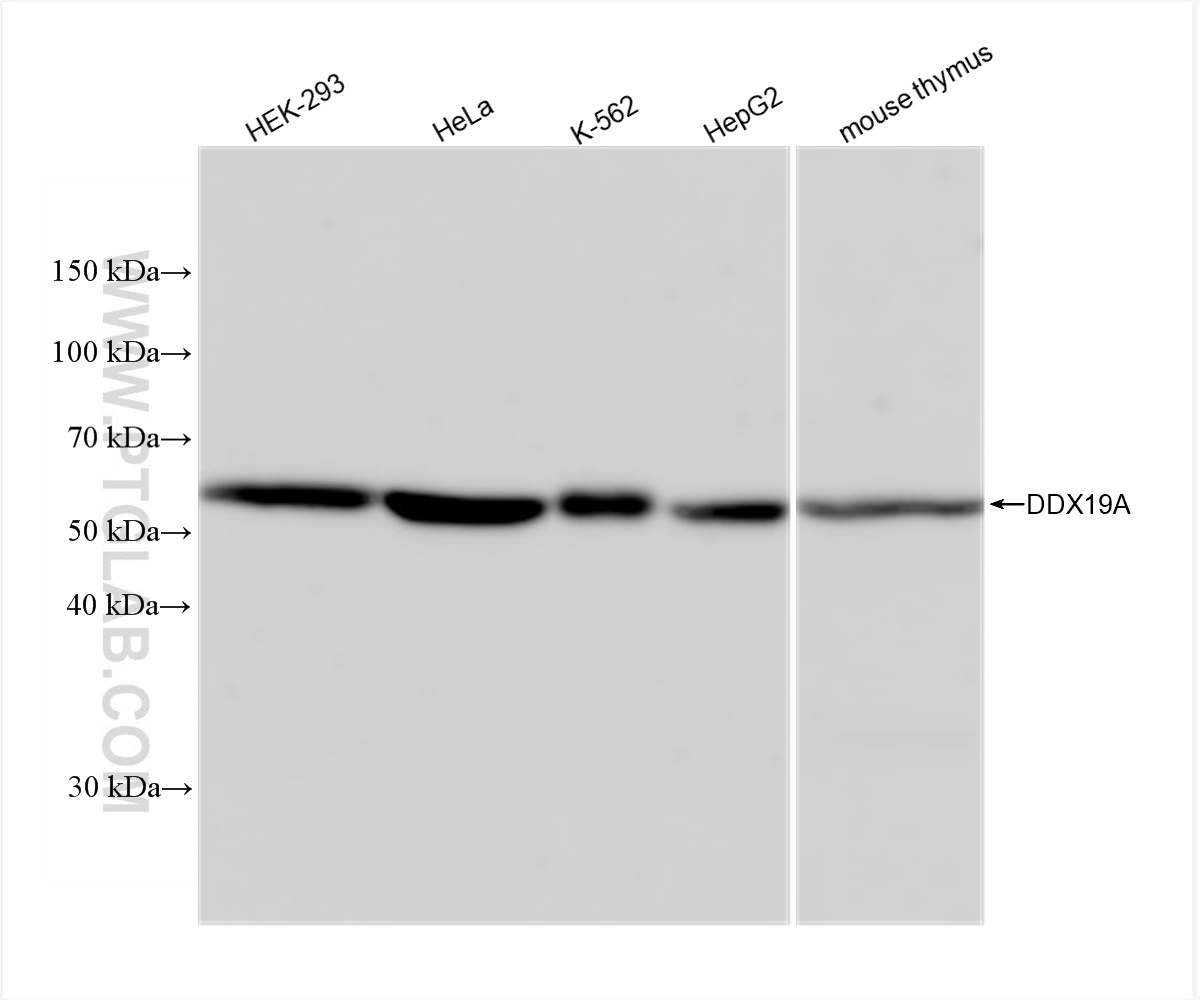 WB analysis using 83106-1-RR (same clone as 83106-1-PBS)