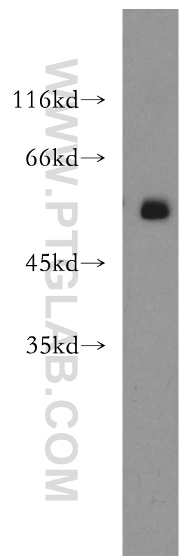 WB analysis of K-562 using 18285-1-AP