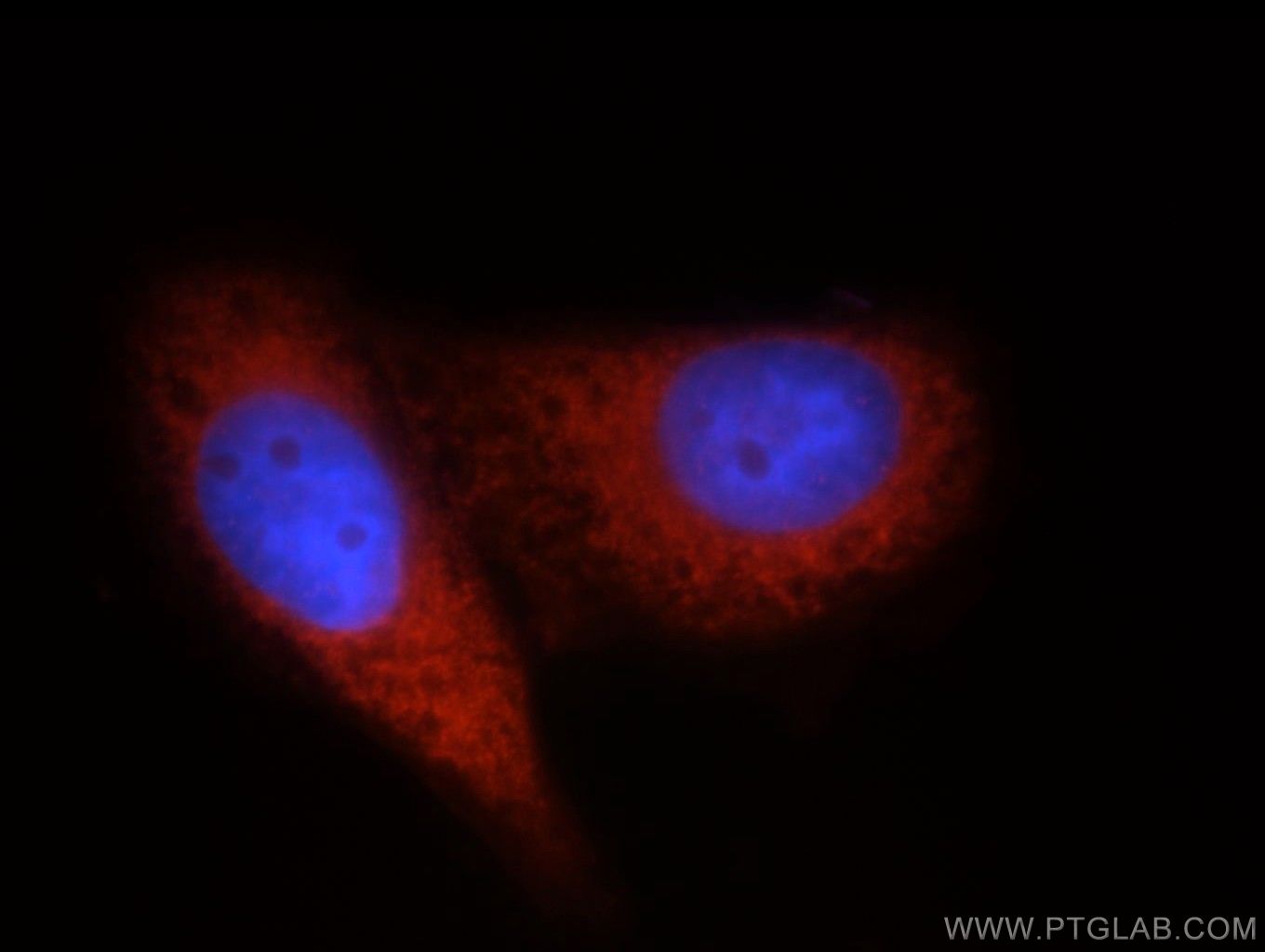 IF Staining of HepG2 using 11324-1-AP