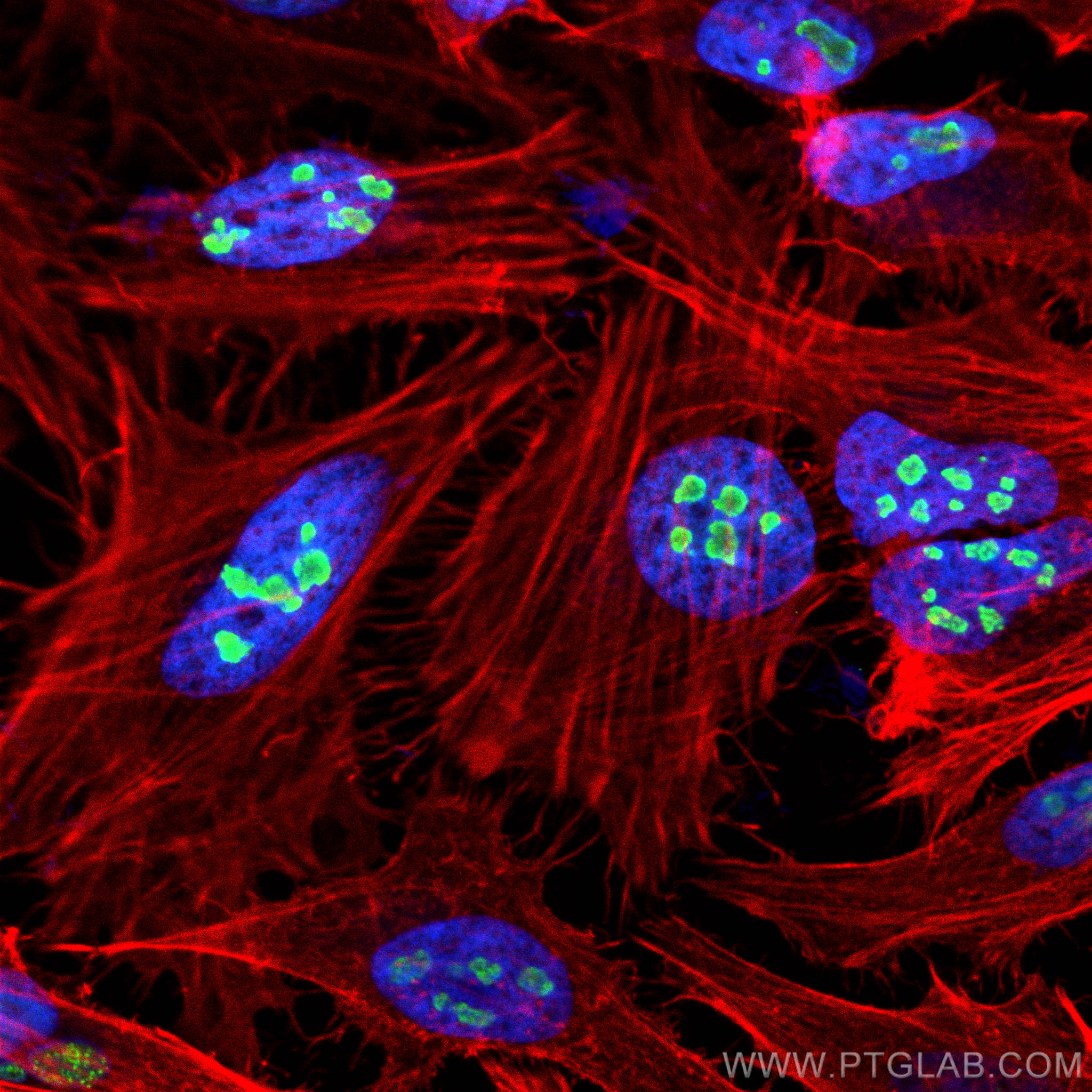 IF Staining of HeLa using 10528-1-AP