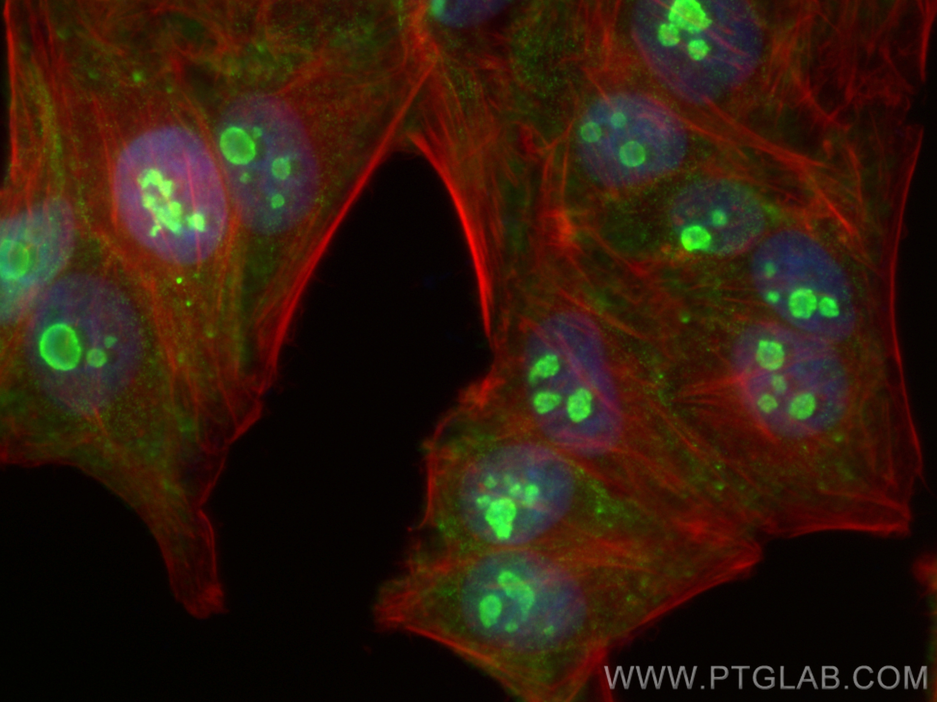 IF Staining of HepG2 using 66925-1-Ig (same clone as 66925-1-PBS)