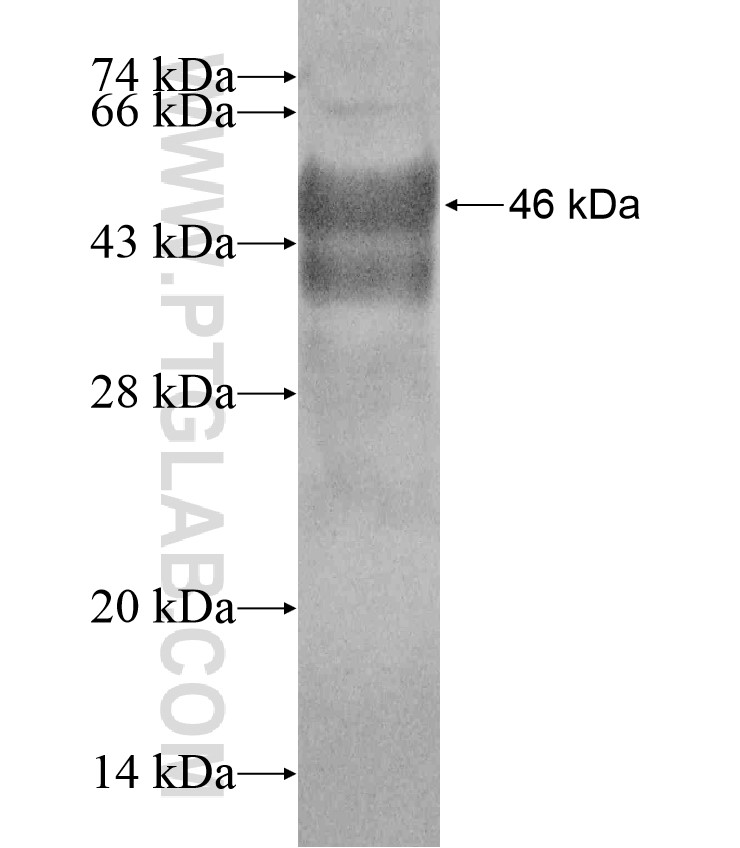 DDX21 fusion protein Ag17741 SDS-PAGE DDX21 fusion protein Ag17741 SDS-PAGE