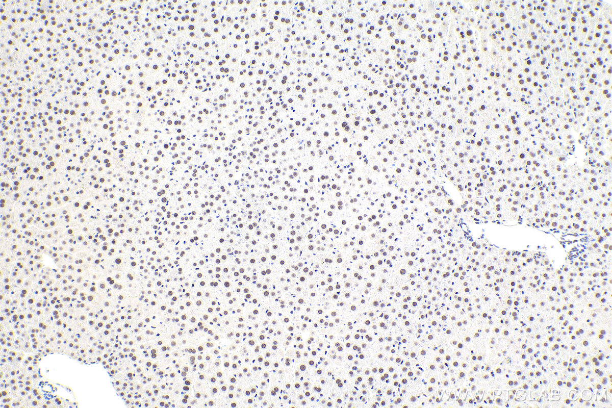 IHC staining of mouse liver using 10199-2-AP IHC staining of mouse liver using 10199-2-AP