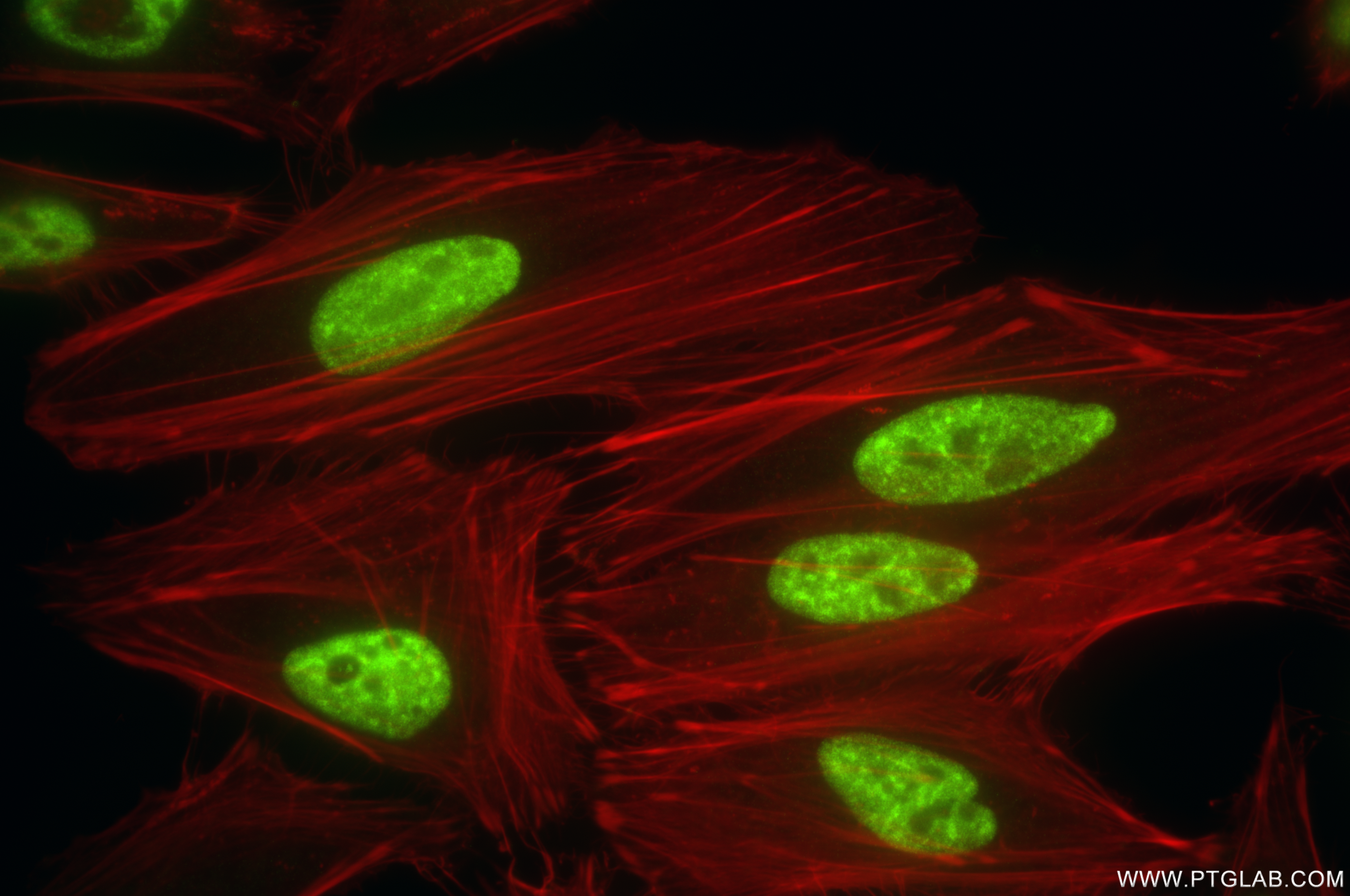 IF Staining of HeLa using 85763-4-RR