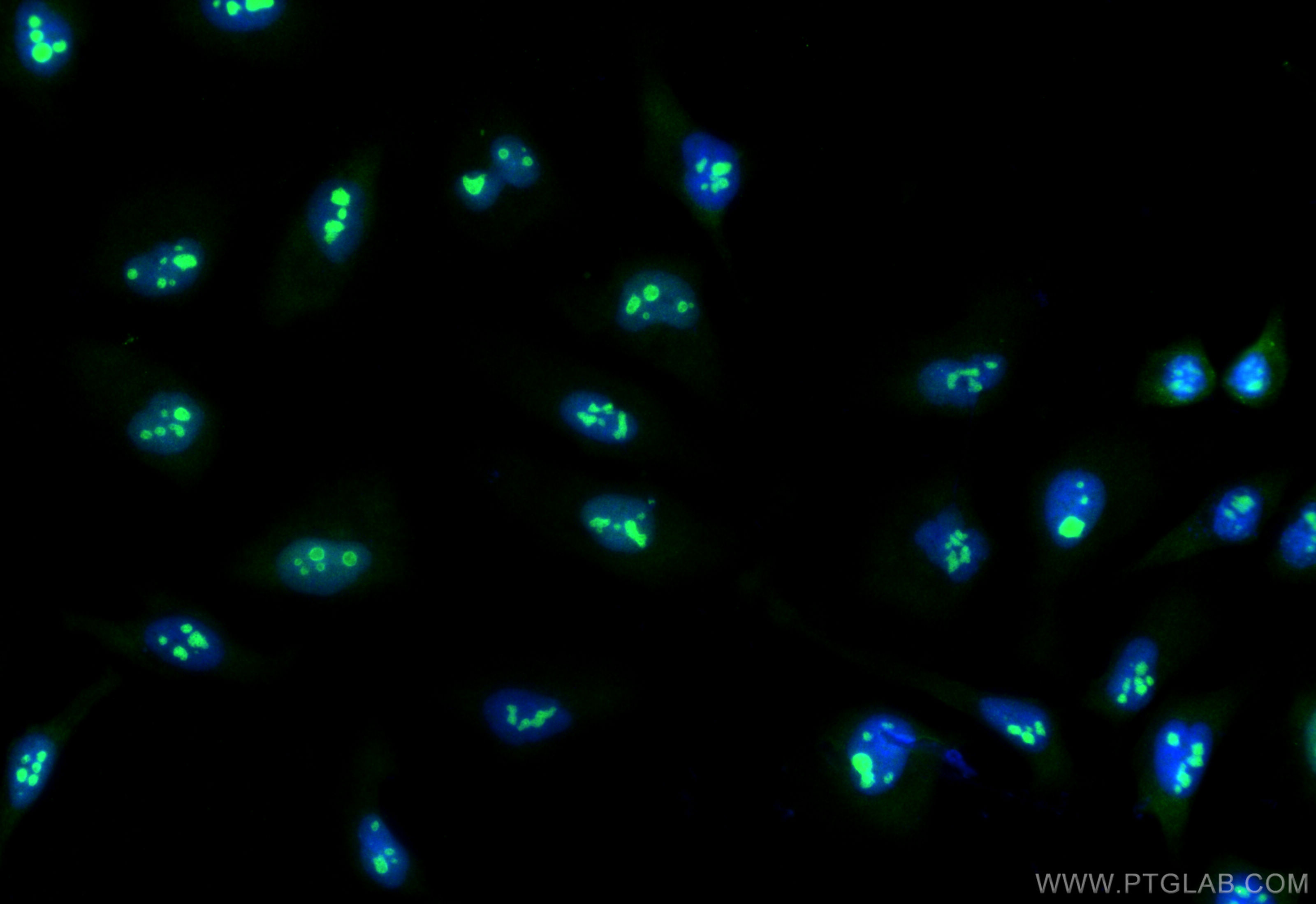 IF Staining of HeLa using 84103-6-RR