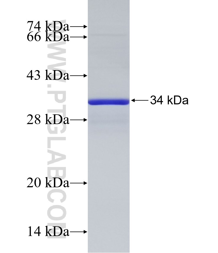 DDX25 fusion protein Ag33061 SDS-PAGE DDX25 fusion protein Ag33061 SDS-PAGE