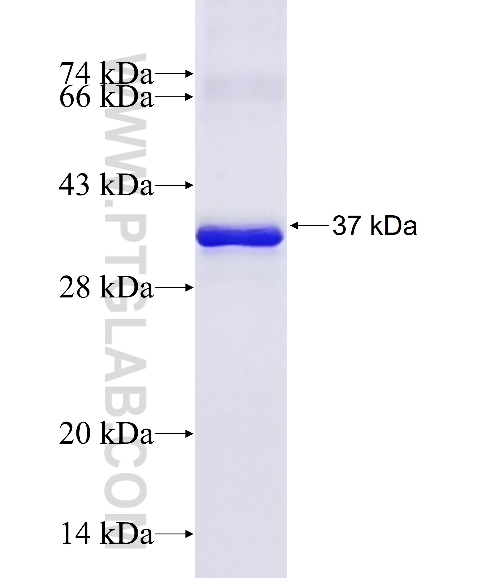 DDX26B fusion protein Ag37016 SDS-PAGE DDX26B fusion protein Ag37016 SDS-PAGE