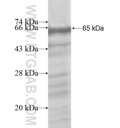 DDX27 fusion protein Ag9433 SDS-PAGE DDX27 fusion protein Ag9433 SDS-PAGE