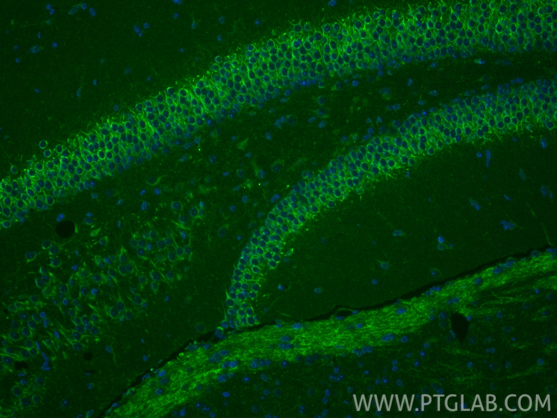 IF Staining of mouse brain using 11617-1-AP IF Staining of mouse brain using 11617-1-AP