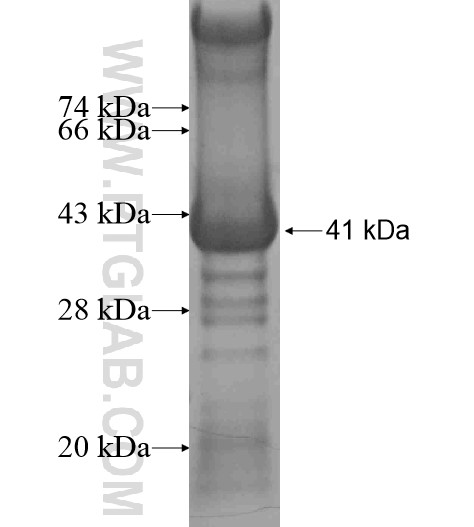 DDX39 fusion protein Ag15404 SDS-PAGE DDX39 fusion protein Ag15404 SDS-PAGE