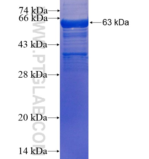DDX39 fusion protein Ag2311 SDS-PAGE