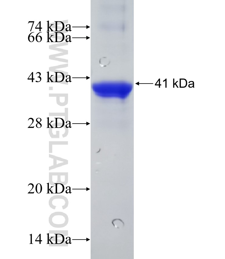 DDX3Y fusion protein Ag31231 SDS-PAGE