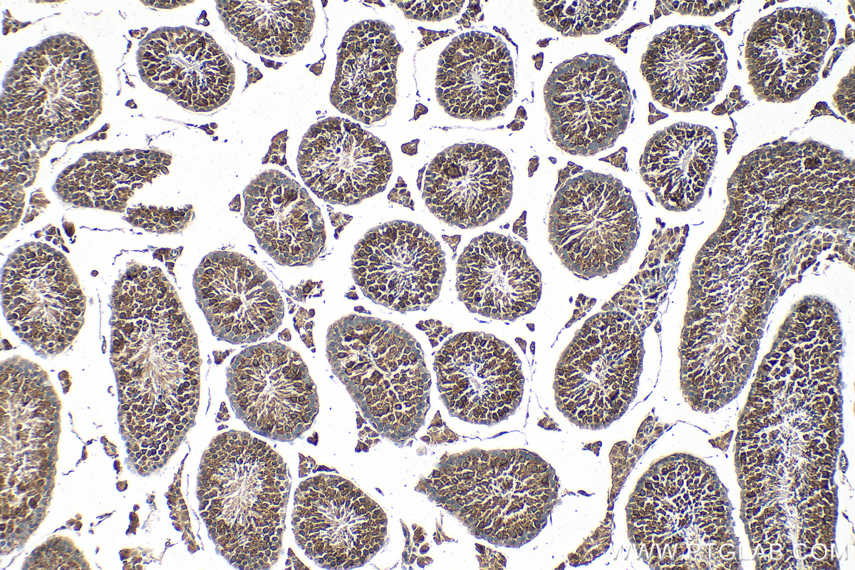 IHC staining of mouse testis using 67147-2-Ig