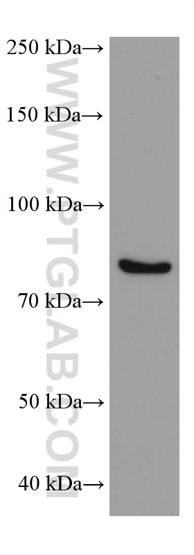 WB analysis of SKOV-3 using 67147-2-Ig