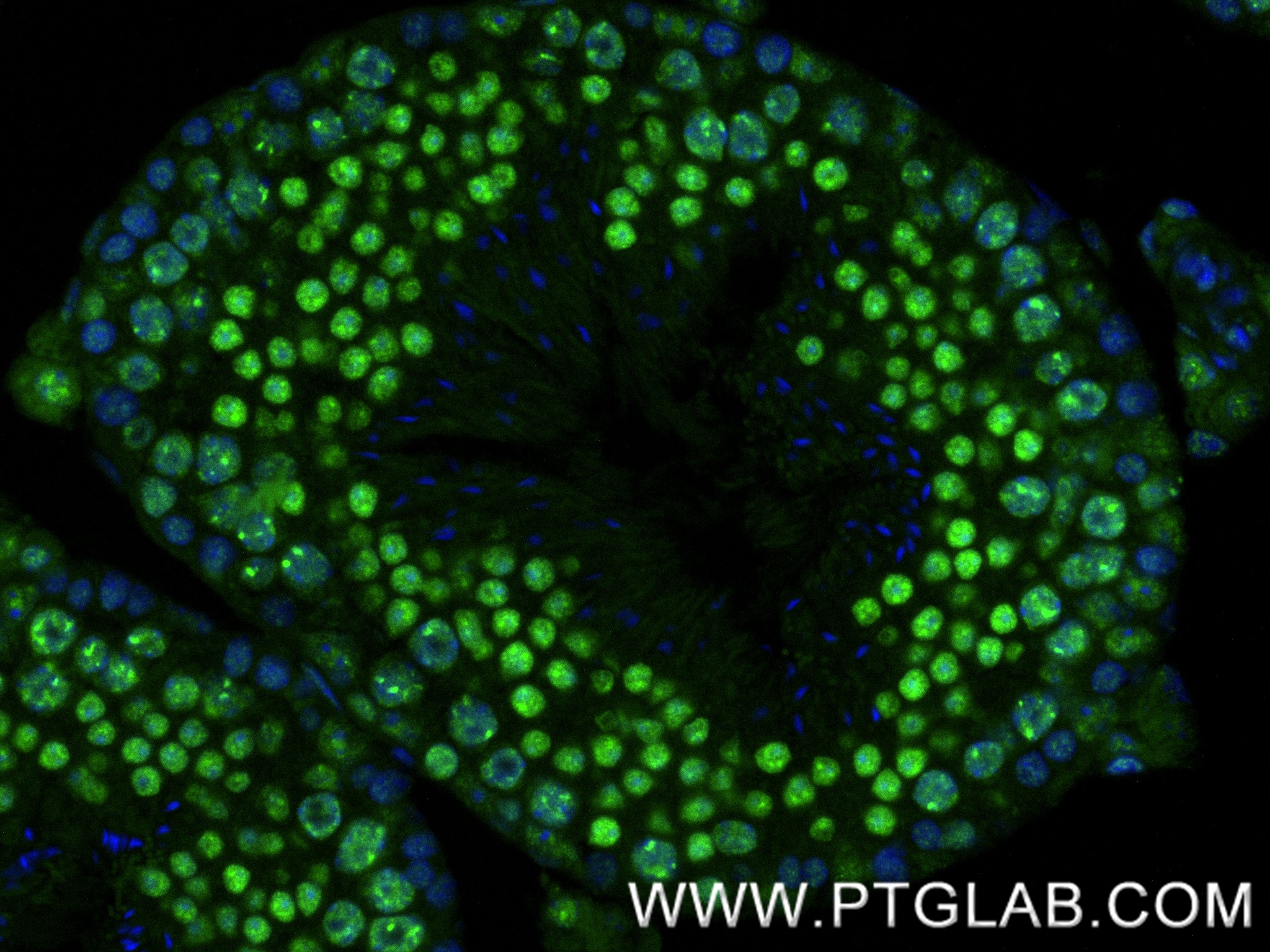 IF Staining of mouse testis using 86894-1-RR (same clone as 86894-1-PBS) IF Staining of mouse testis using 86894-1-RR (same clone as 86894-1-PBS)