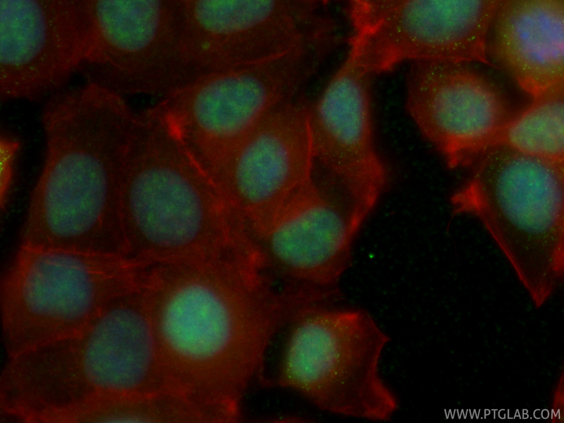 IF Staining of MCF-7 using CL488-86894