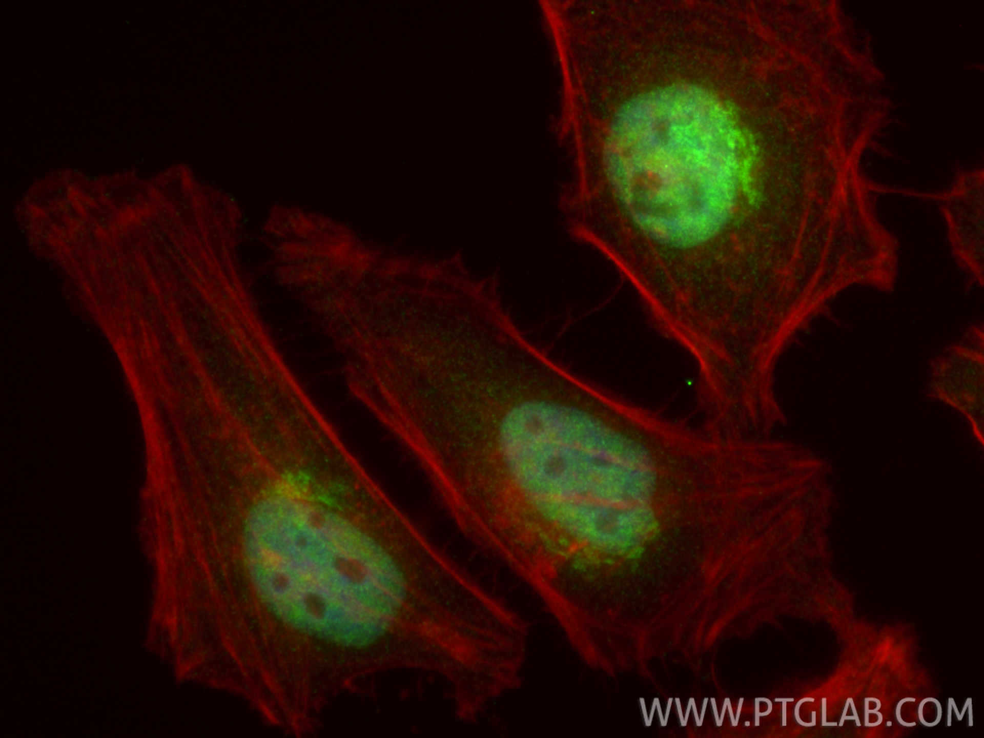 IF Staining of HeLa using 31211-1-AP (same clone as 31211-1-PBS) IF Staining of HeLa using 31211-1-AP (same clone as 31211-1-PBS)