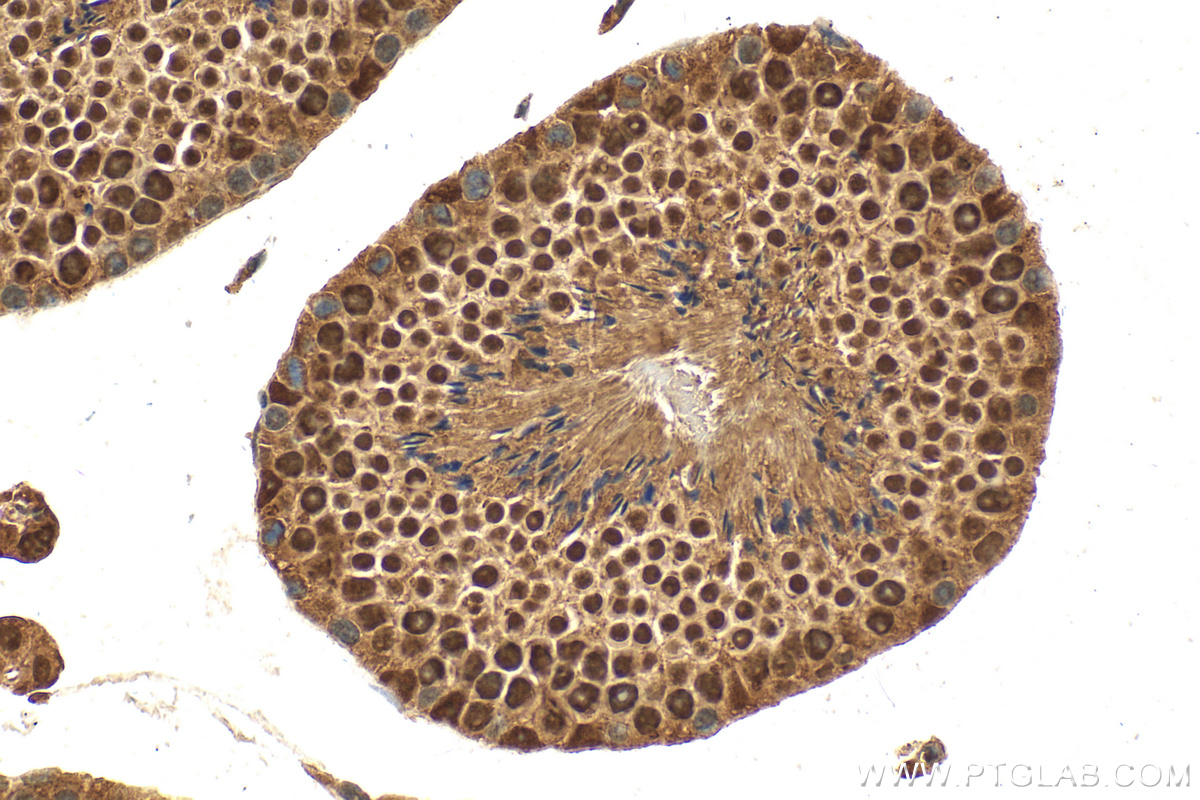 IHC staining of mouse testis using 31211-1-AP
