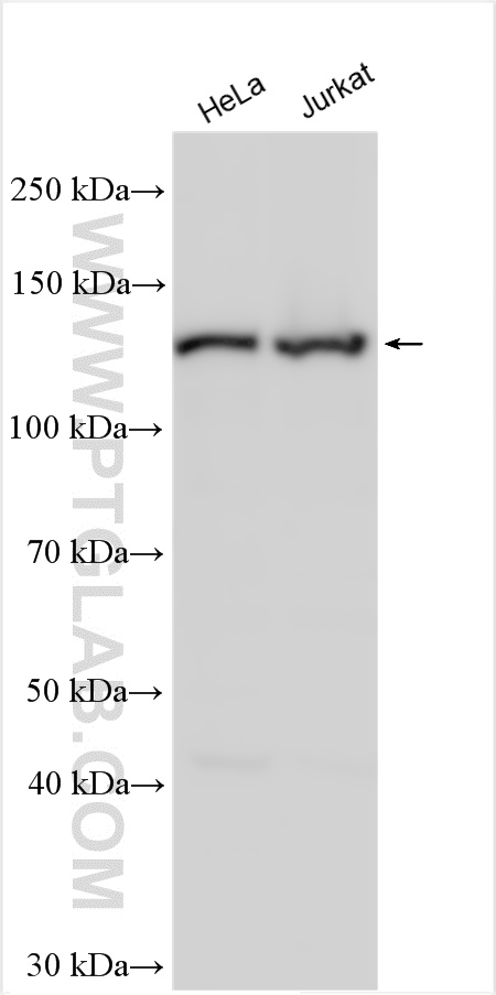 WB analysis using 31211-1-AP