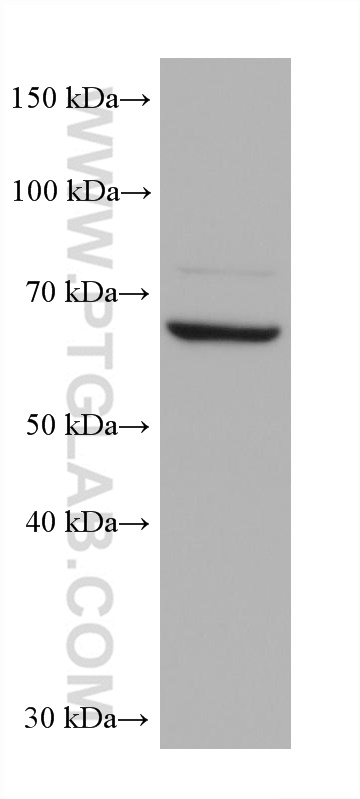 WB analysis using 68454-1-Ig