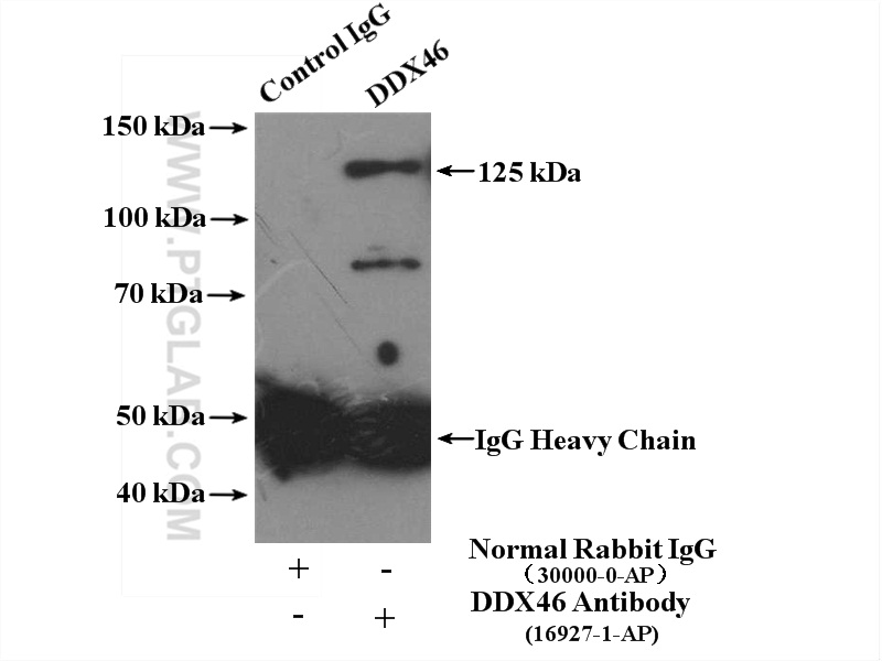 IP experiment of NIH/3T3 using 16927-1-AP