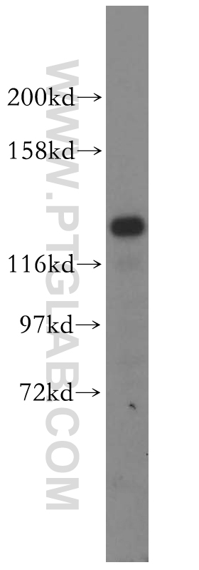 WB analysis of HEK-293 using 16927-1-AP