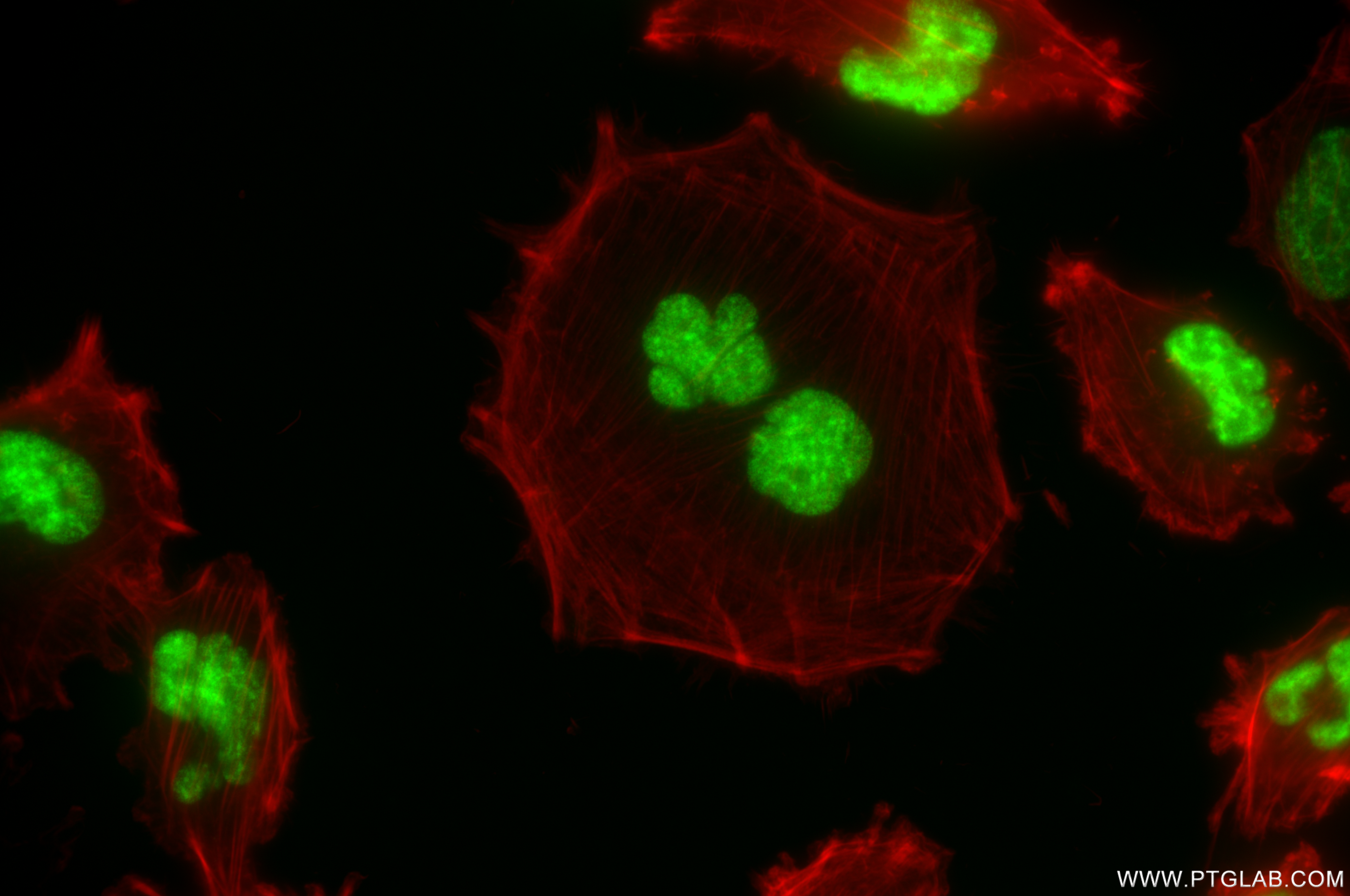 IF Staining of U-251 using 85065-3-RR (same clone as 85065-3-PBS)