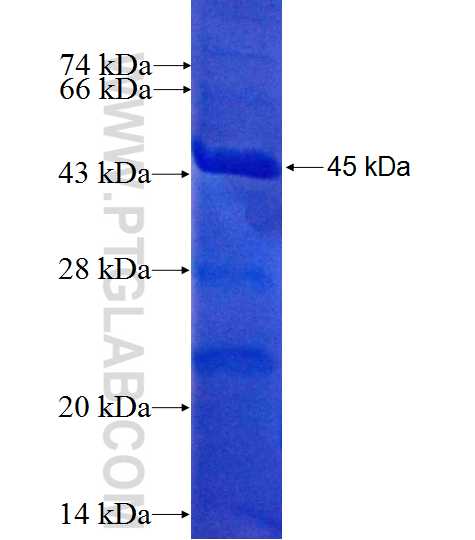 DDX46 fusion protein Ag10465 SDS-PAGE DDX46 fusion protein Ag10465 SDS-PAGE