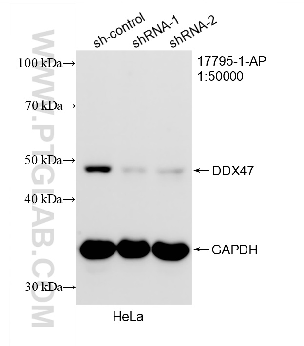 WB analysis of HeLa using 17795-1-AP (same clone as 17795-1-PBS)