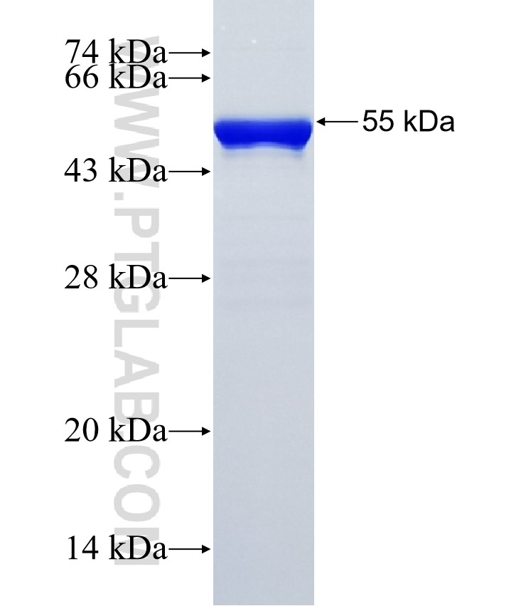 DDX47 fusion protein Ag35438 SDS-PAGE