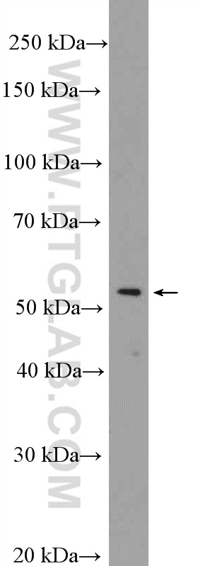 WB analysis of HeLa using 20523-1-AP