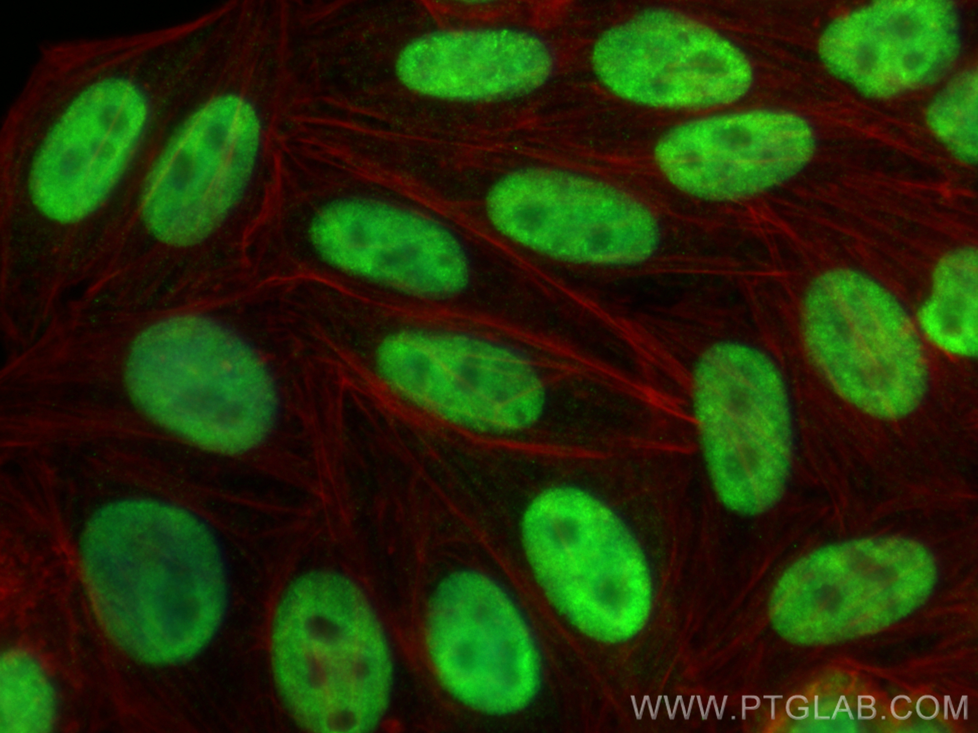 IF Staining of HepG2 using 67025-1-Ig
