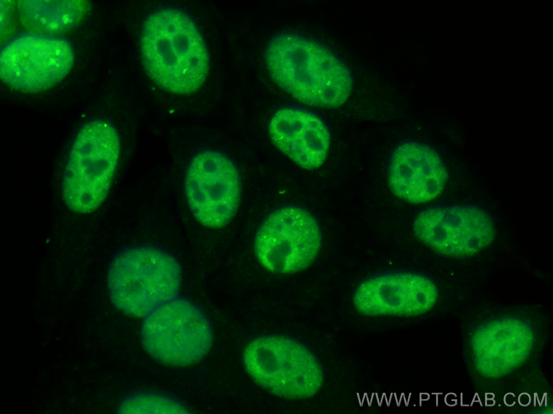 IF Staining of HepG2 using CL488-67025