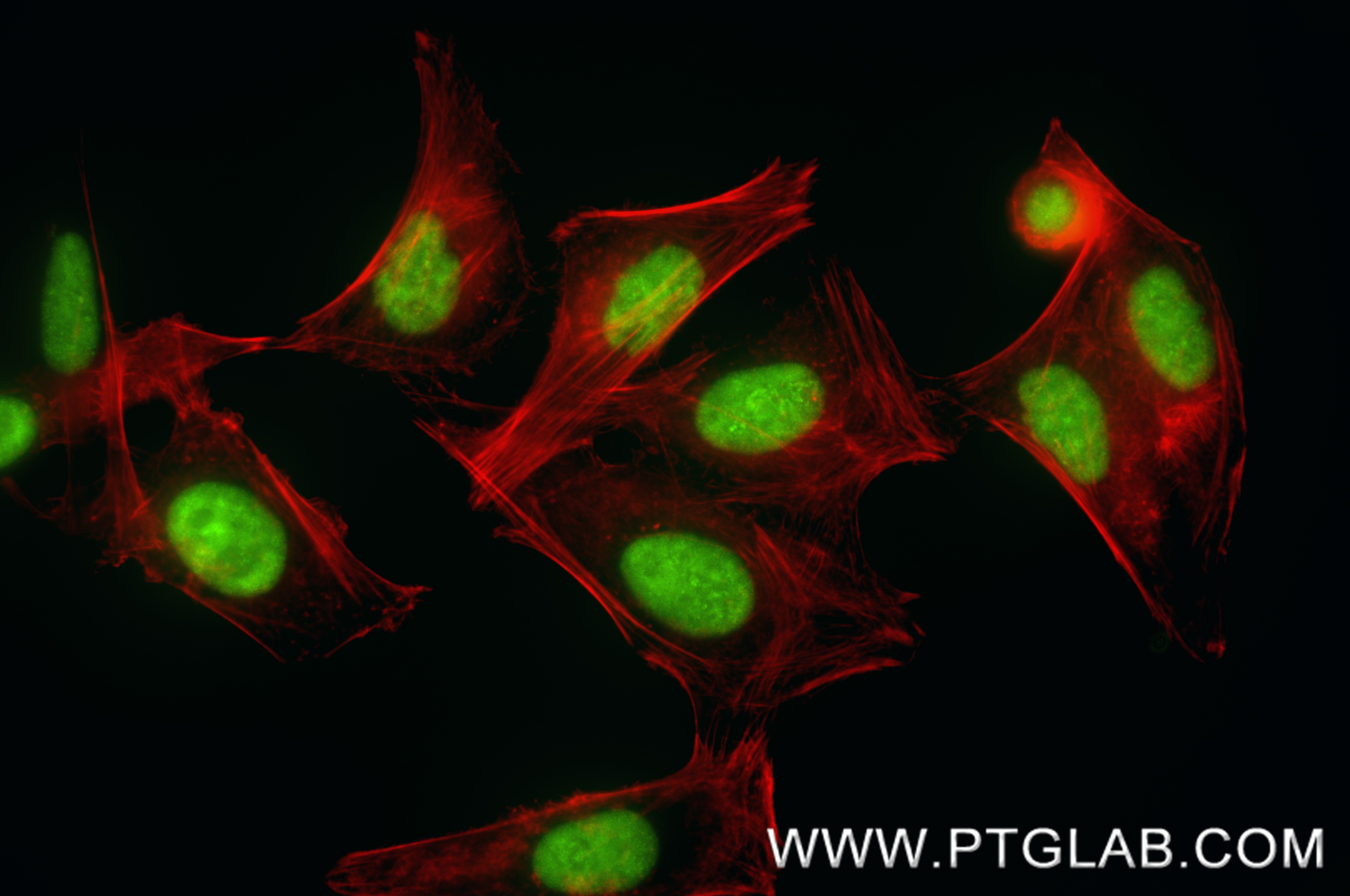 IF Staining of HepG2 using 88502-1-RR (same clone as 88502-1-PBS) IF Staining of HepG2 using 88502-1-RR (same clone as 88502-1-PBS)