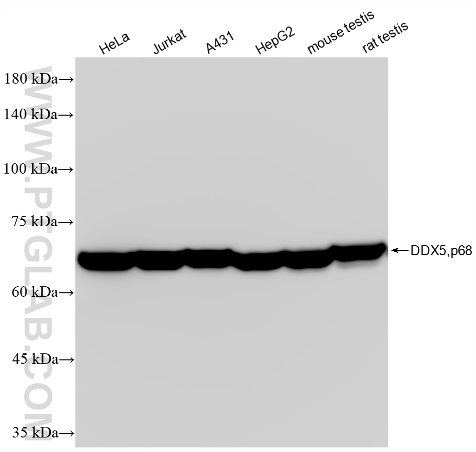 WB analysis using 88502-1-RR (same clone as 88502-1-PBS) WB analysis using 88502-1-RR (same clone as 88502-1-PBS)