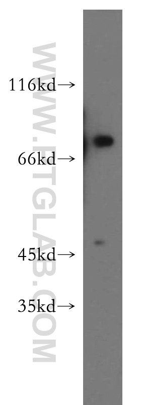 WB analysis of K-562 using 20149-1-AP