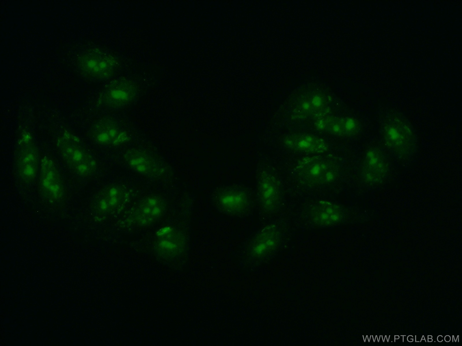 IF Staining of HepG2 using 16660-1-AP