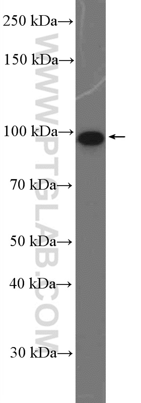 DDX54