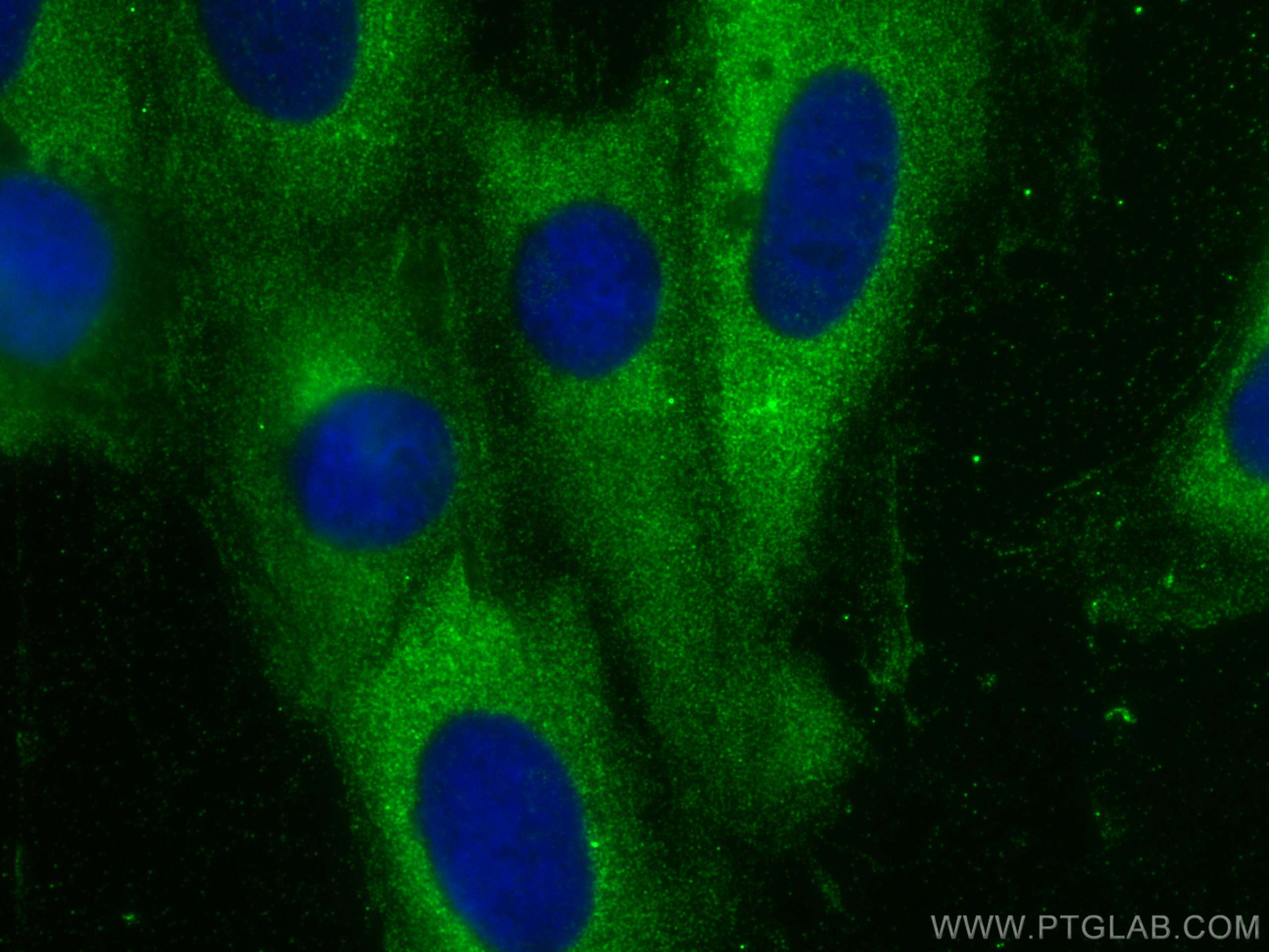 IF Staining of H9C2 using 20566-1-AP (same clone as 20566-1-PBS)
