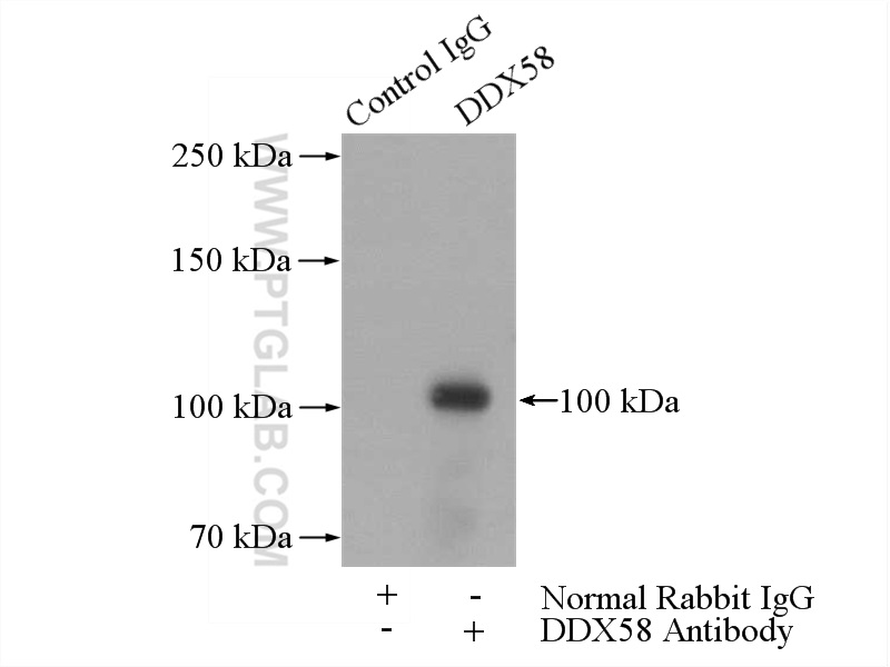 IP experiment of HepG2 using 20566-1-AP (same clone as 20566-1-PBS)