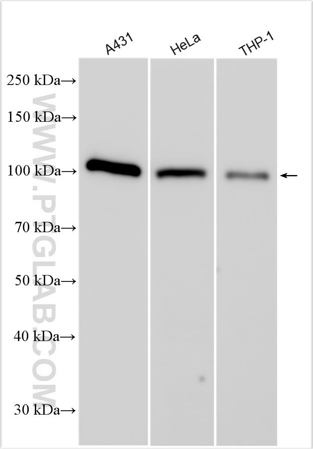 WB analysis using 25068-1-AP