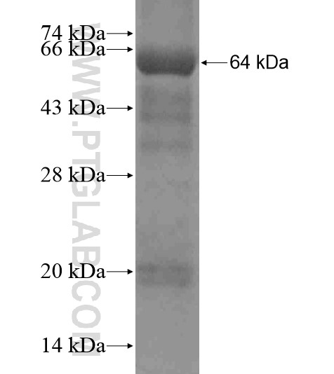 DDX58 fusion protein Ag18585 SDS-PAGE